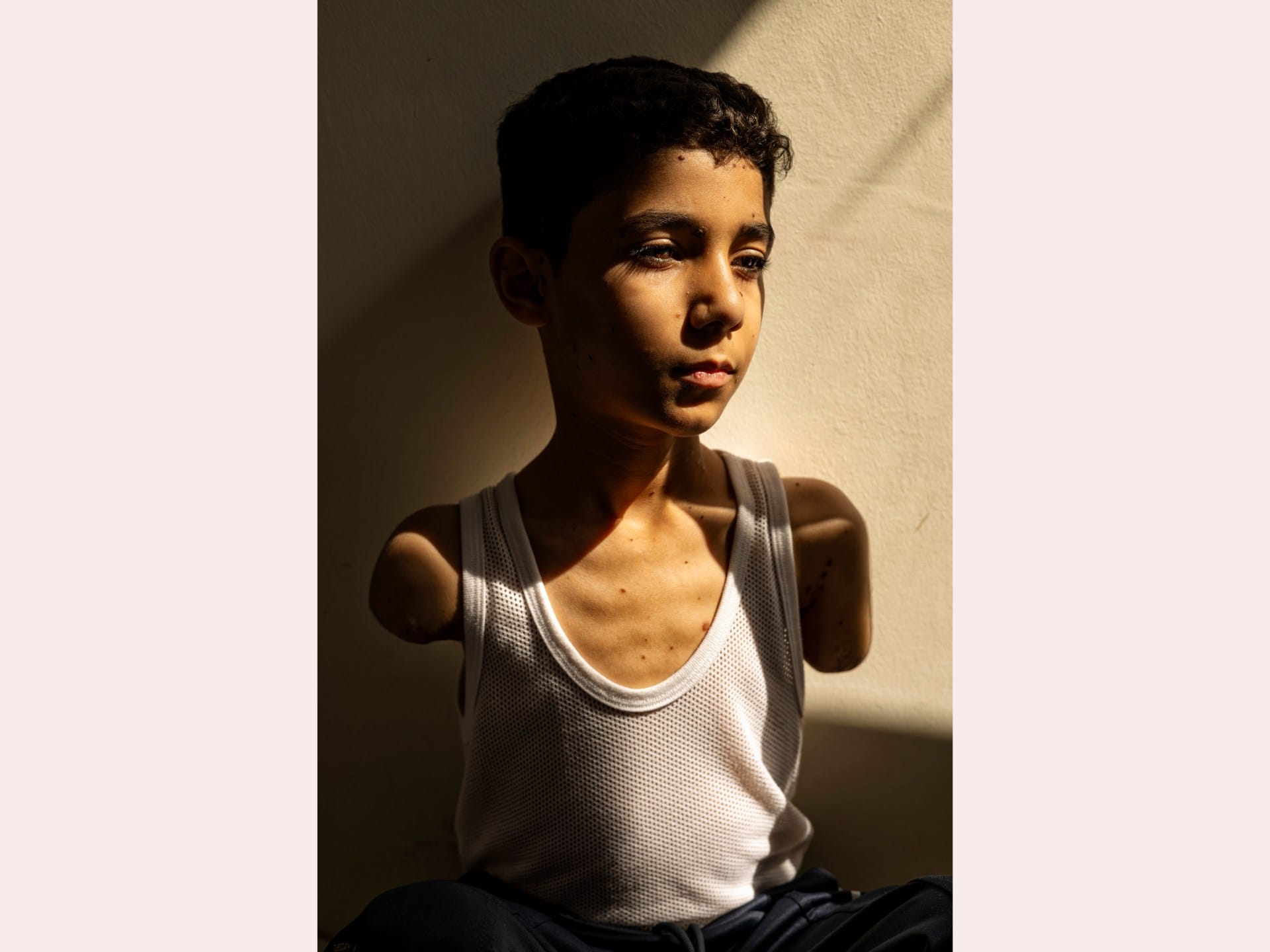 Portrait of amputee Palestinian boy from Gaza wins World Press Photo award | Israel-Palestine conflict News Portrait of amputee Palestinian boy from Gaza wins World Press Photo award | Israel-Palestine conflict News
